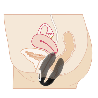Điều khiển từ xa Vibrator massage âm đạo Vibrator âm vật vô hình