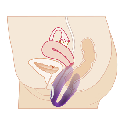 Điều khiển từ xa Vibrator massage âm đạo Vibrator âm vật vô hình